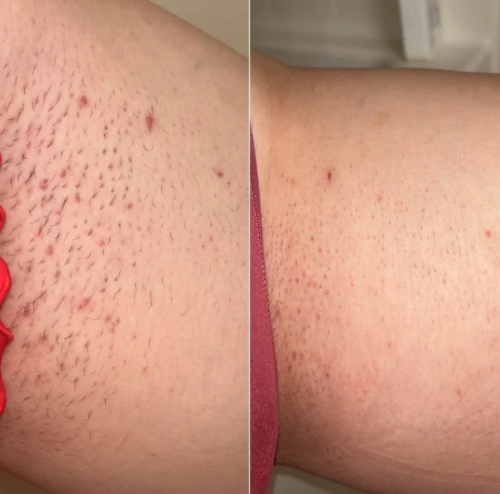 Veloré Smooth & Soothe Roll-On Essence