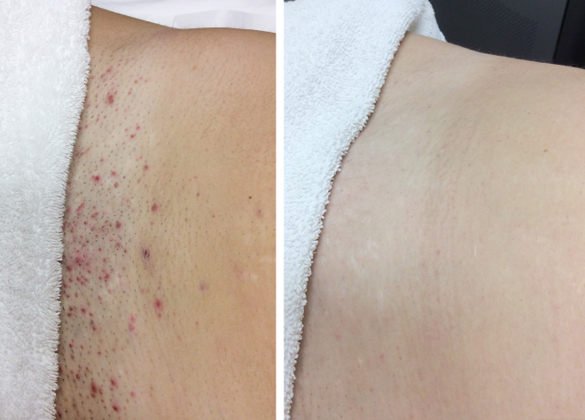 Veloré Smooth & Soothe Roll-On Essence